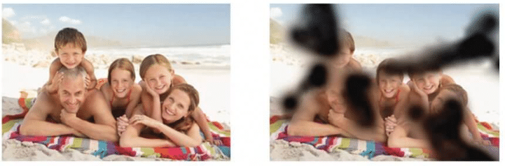 Example of Diabetic Retinopathy